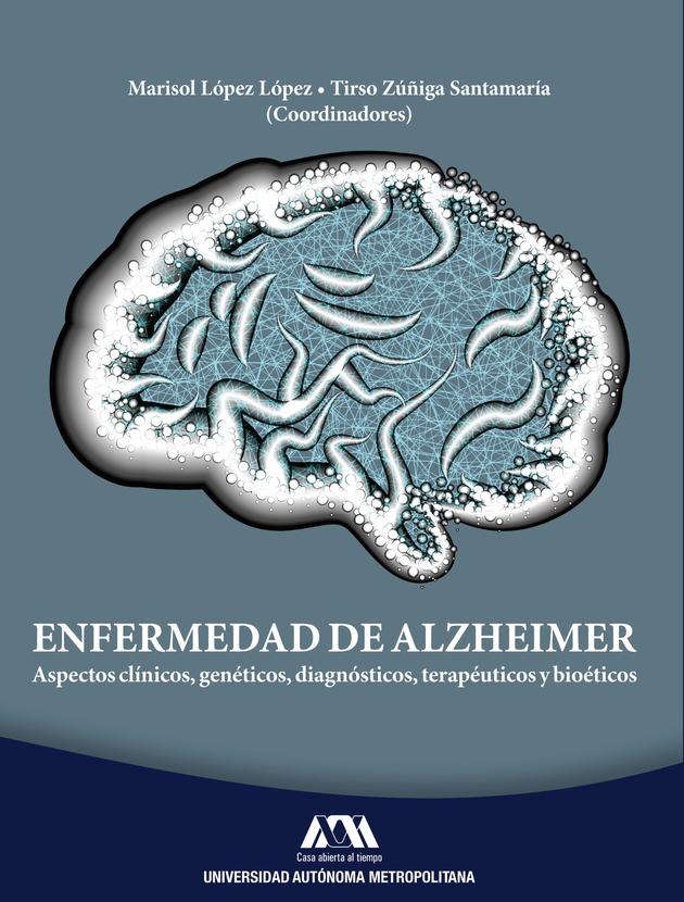 Enfermedad de Alzheimer